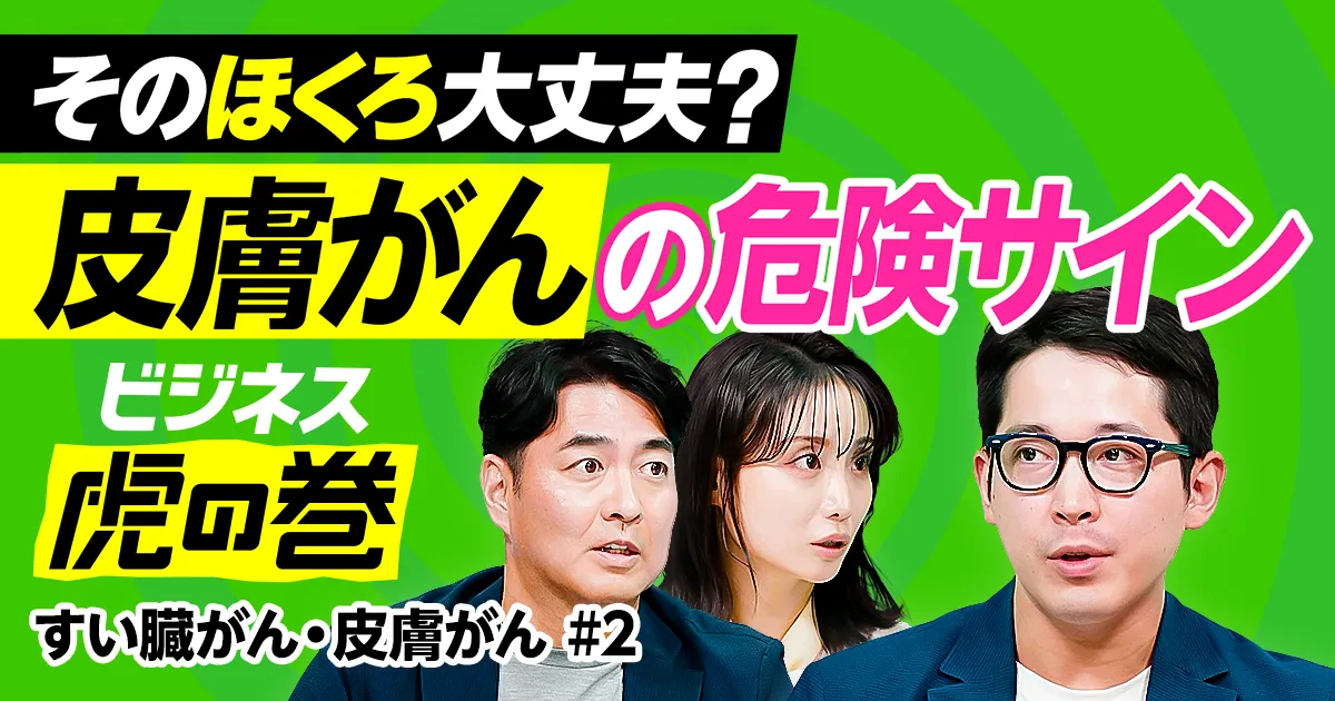 見落としがちな「がん」の危険サイン／ホクロにそっくりな皮膚がん