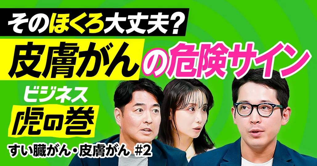 見落としがちな「がん」の危険サイン／ホクロにそっくりな皮膚がん